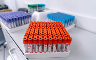 4 Types of Lab Trays and When You Should Use Them